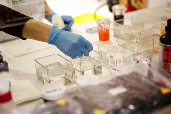 El Biobanco andaluz provee de más de 10.200 muestras a la comunidad científica para la investigación en salud